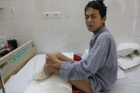 Bỏng điện cao thế, cậu bé 15 tuổi mất một cánh tay và hai cẳng chân
